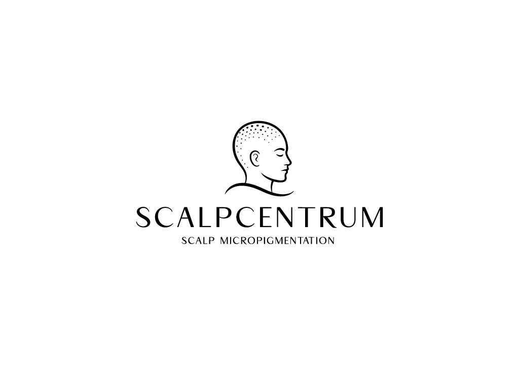 Scalp micropigmentation-behandling hos Scalpcentrum i Göteborg